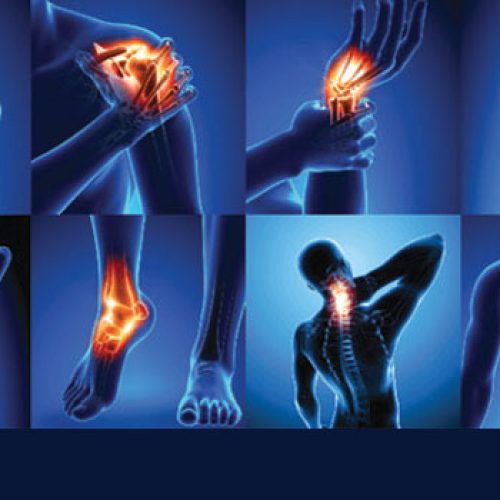 गठिया (arthritis) रोग क्या है? यौगिक उपचार और लक्षण, कारण