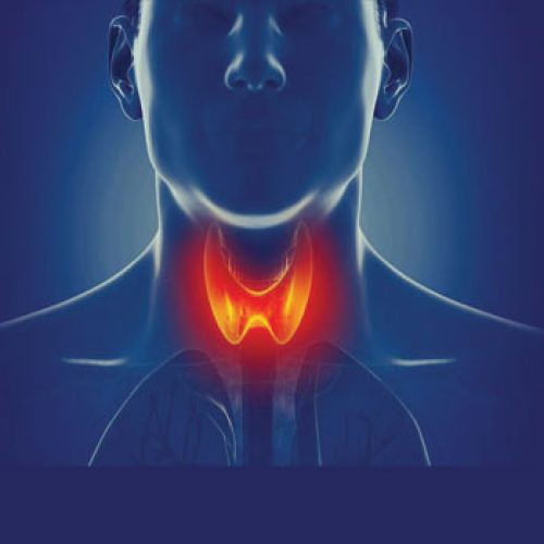 थायराइड (Thyroid) क्या है इसके प्रकार, लक्षण और परहेज या घरेलू उपचार